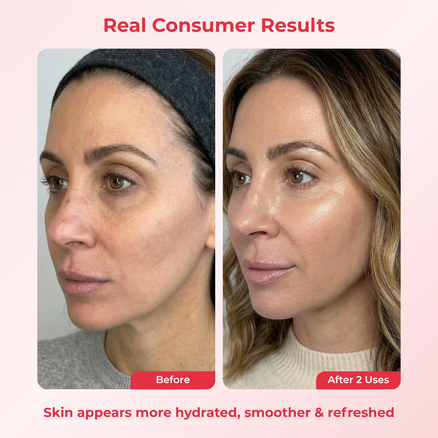 PDRN Deep Mask (4 Masks).